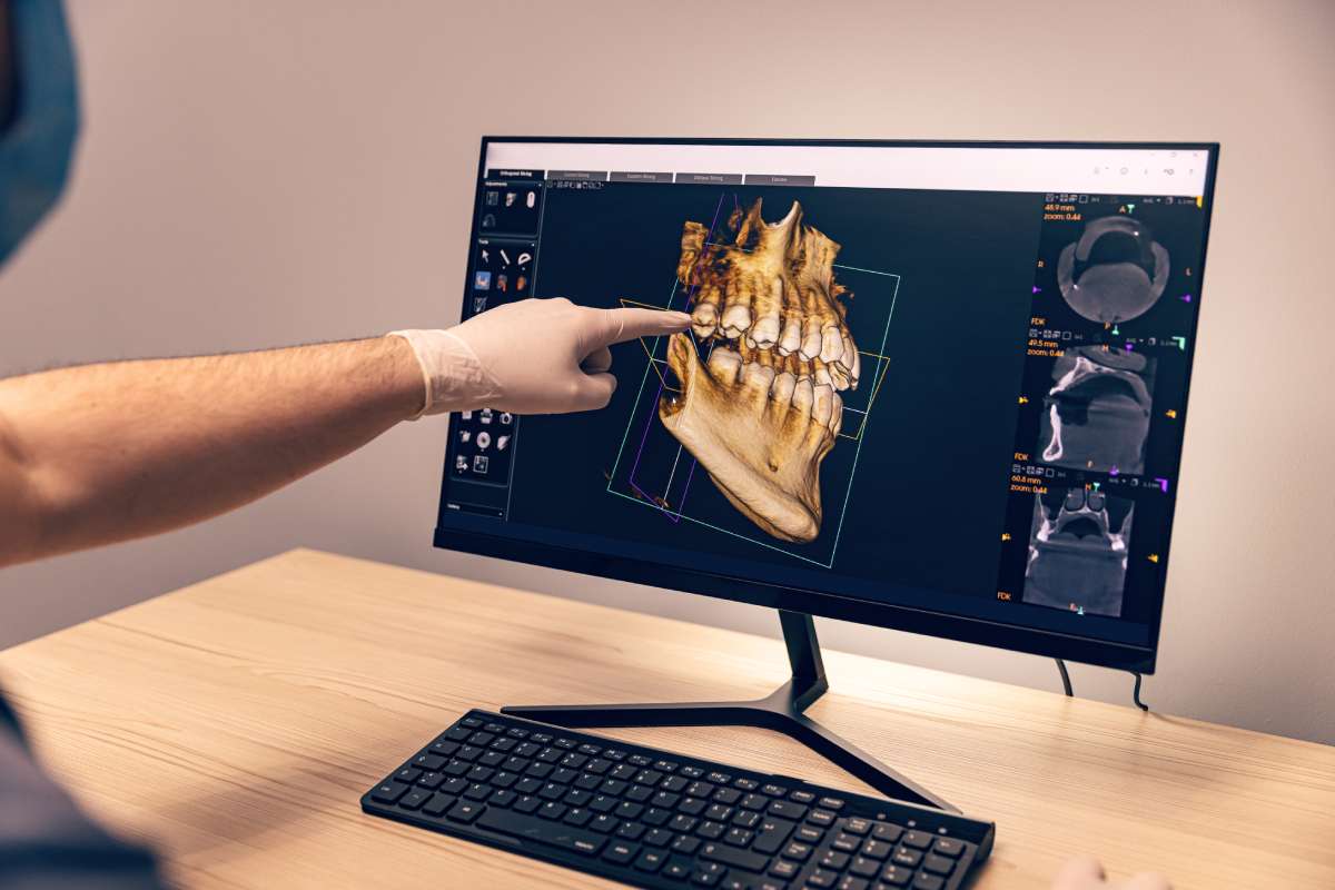 Digital Smile Design